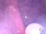 CAM INSIDE ASS: The Balls disappeared deep inside my hole ⚽⛓ – Preview